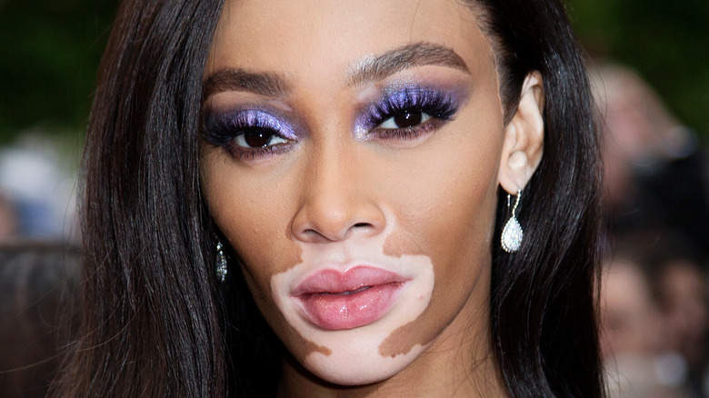 Winnie Harlow sul red carpet 