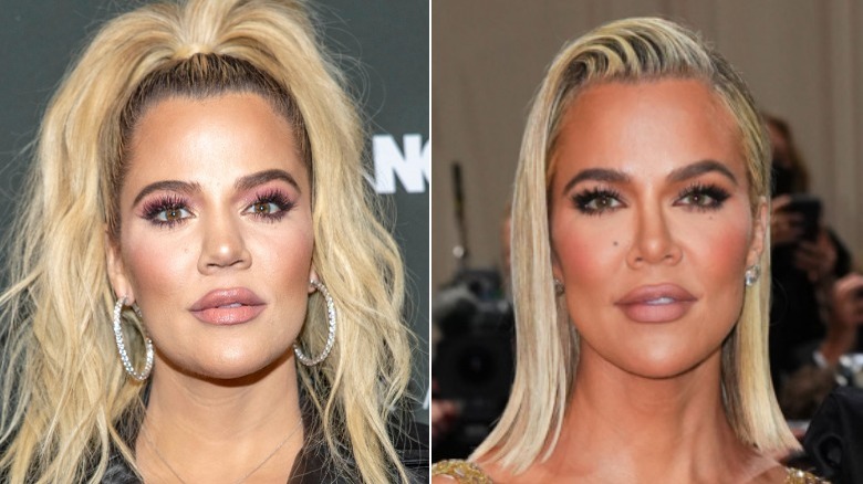 Immagini affiancate di Khloe Kardashian in posa prima e dopo il suo lavoro al naso