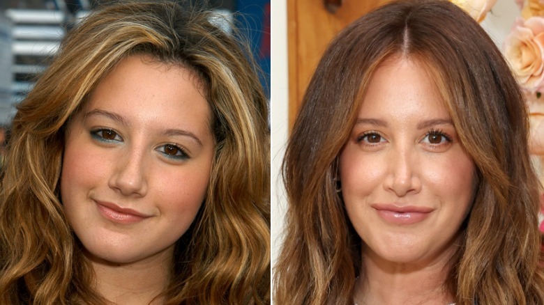 Foto affiancate di Ashley Tisdale sorridente prima e dopo il suo lavoro al naso