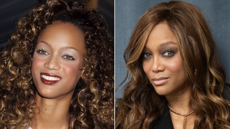 Immagini affiancate di Tyra Banks che sorride prima e dopo il suo lavoro al naso