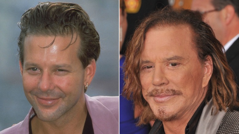 Foto affiancate di Mickey Rourke sorridente prima e dopo il suo intervento al naso