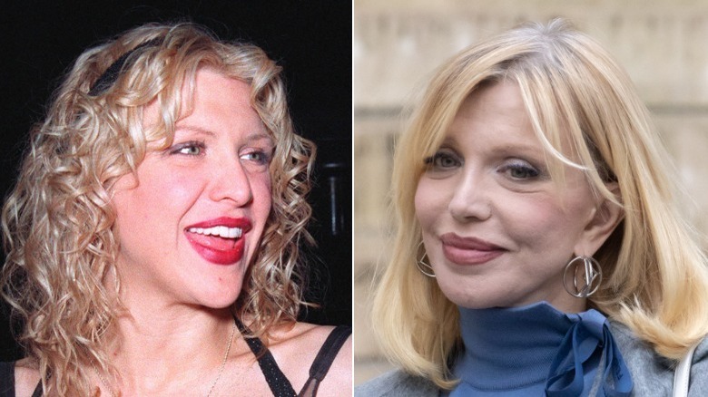 Foto affiancate di Courtney Love sorridente prima e dopo il suo lavoro al naso