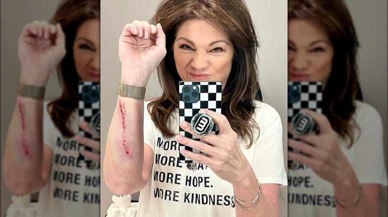 Valerie Bertinelli posa per un selfie con il braccio ferito.