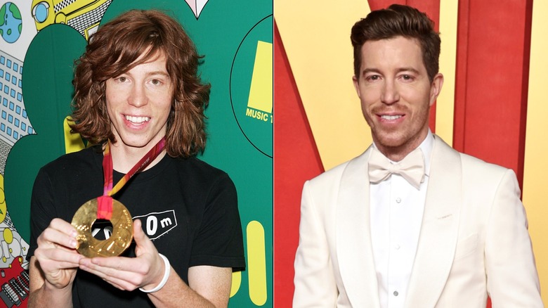 Shaun White con i capelli lunghi, capelli corti