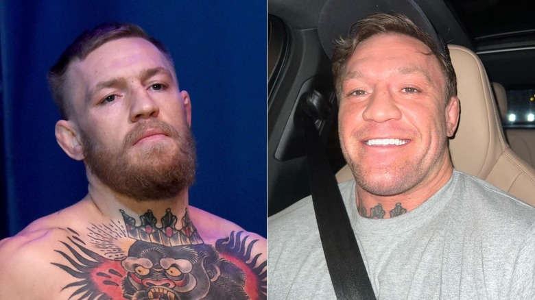 Conor McGregor con e senza barba