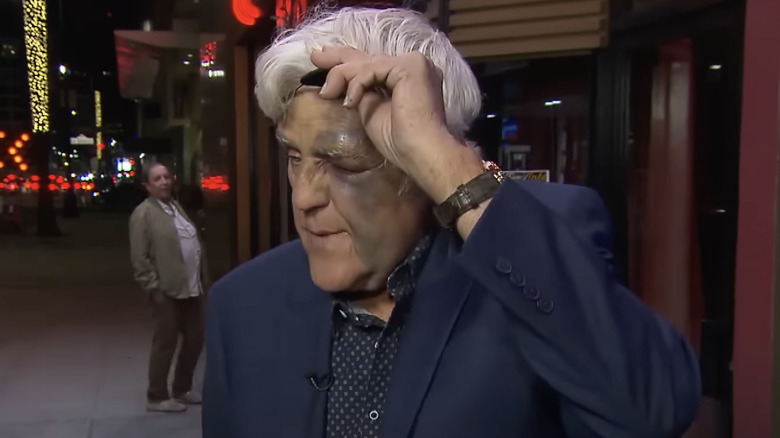 Jay Leno mostra la benda nera sotto l'occhio alla Inside Edition